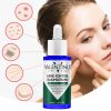 Akne Serumu 30 ml