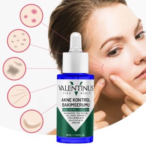 Akne Serumu 30 ml